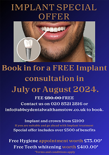 Implant Special Offer